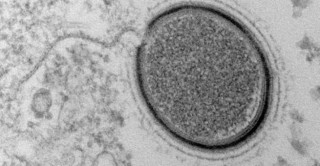 اكتشاف فيروس عملاق عمره 30 ألف عام 