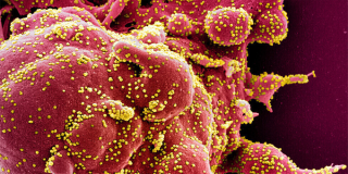 الصحة العالمية: عدوى فيروس كورونا قد تتحول إلى مرض جهازي 